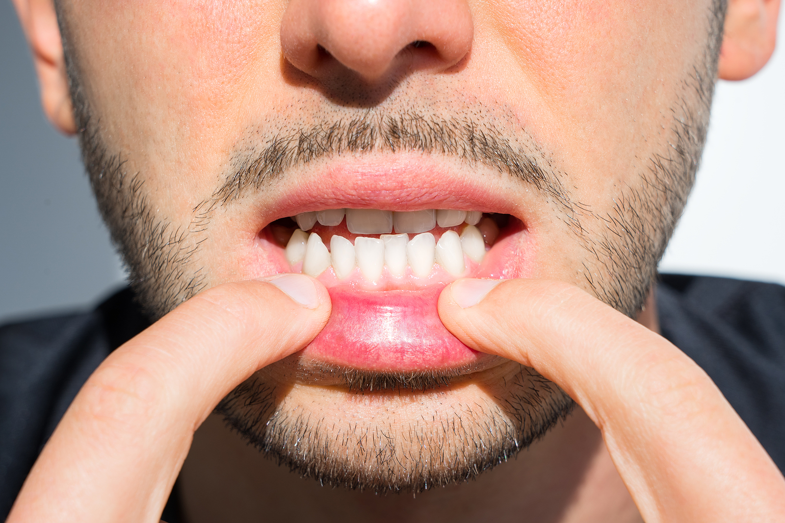 Orthodontic FAQs
