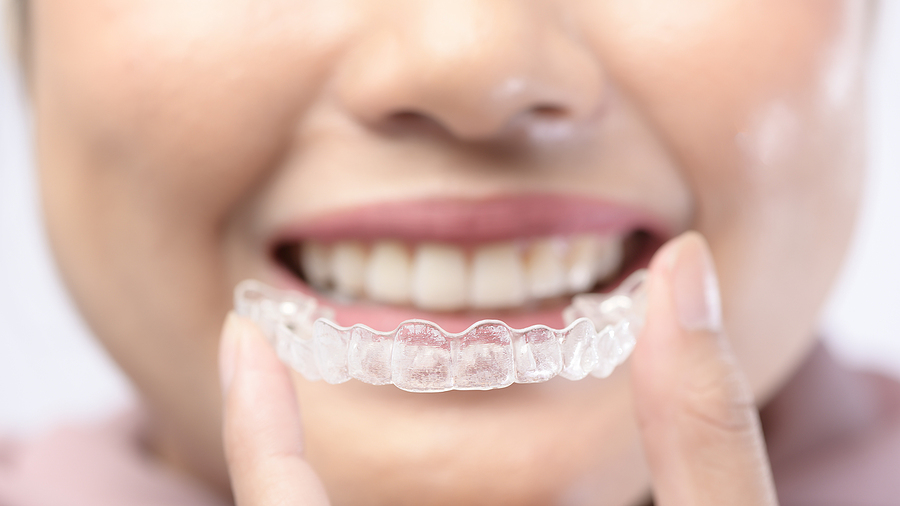 Post-Orthodontic Care